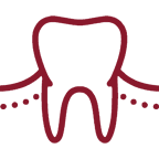 Dental Cervical Abrasions